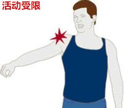 有肩周炎病,買的膏藥貼在哪個(gè)地方是正確的?