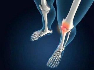 膏藥可以徹底治療滑膜炎嗎？