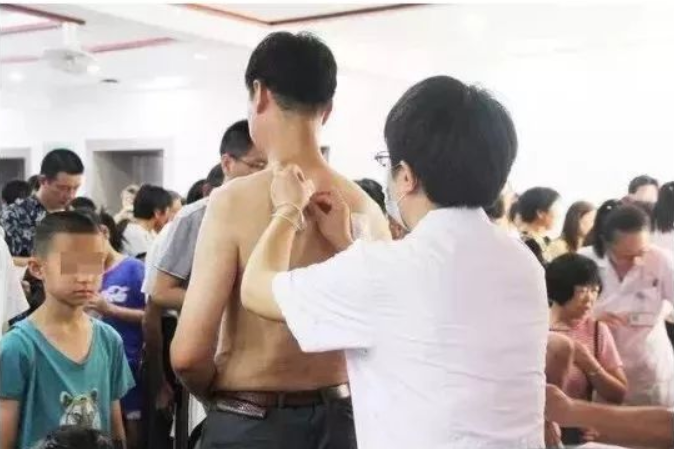 三伏貼有用嗎？什么時候開始