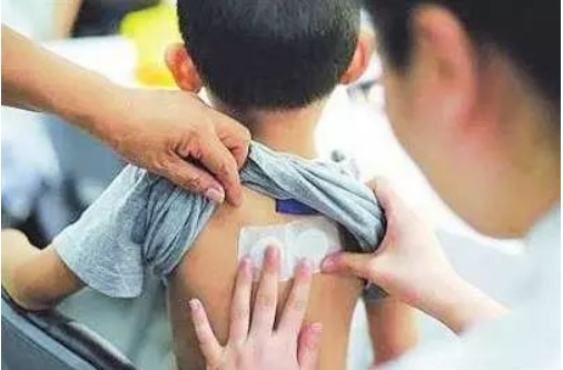 三伏貼——“末伏”貼，于8月11日開始 